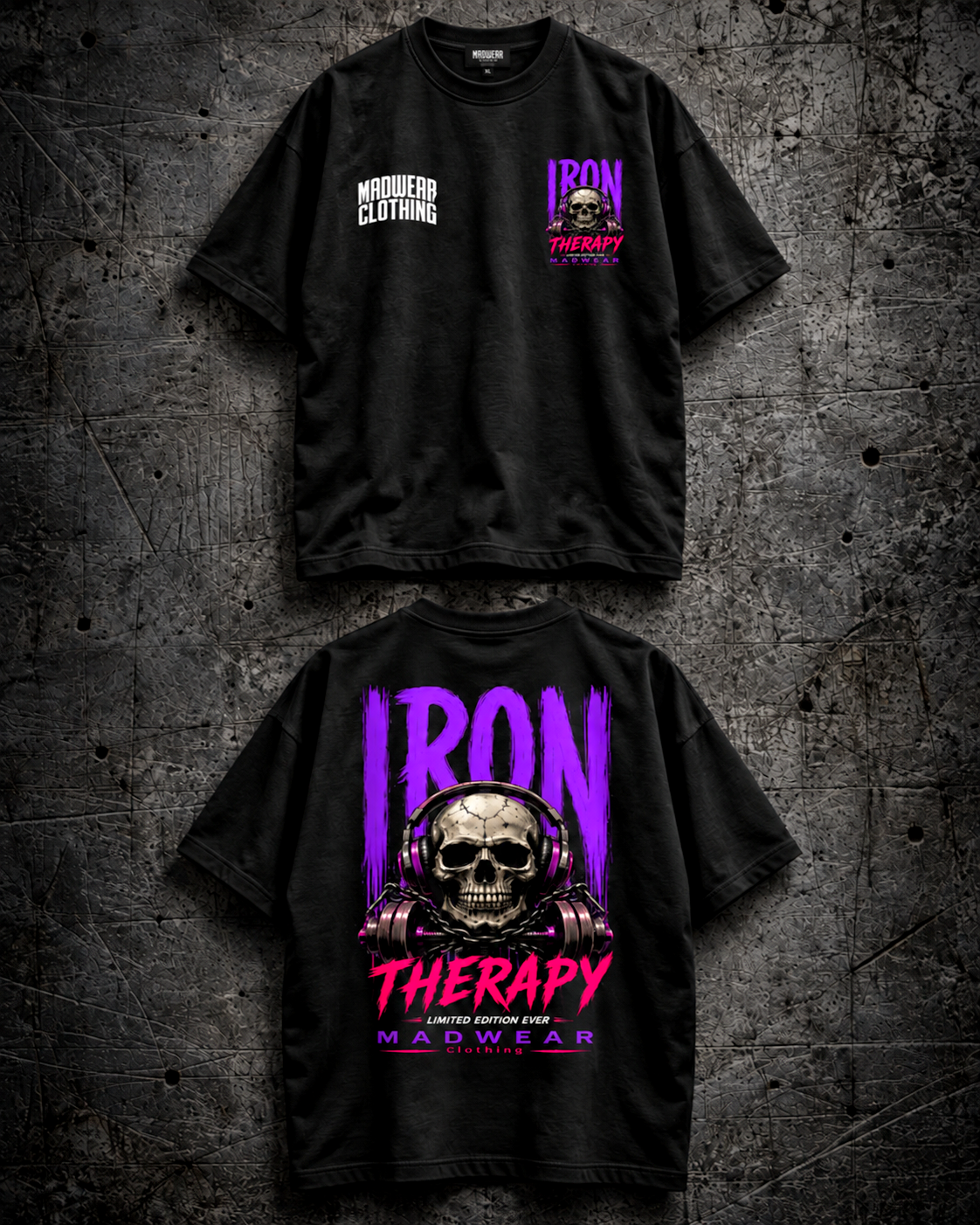 IRON THERAPY OVERSIZED